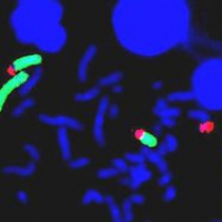 Определение мутаций в гене CALR при ХМПЗ