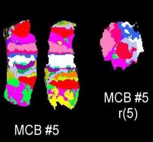 mcb